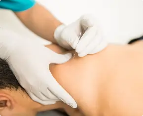 closeup-shirtless-man-receiving-dry-needling-therapy-from-doctor-clinic